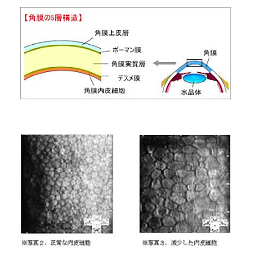 第30回「角膜内皮細胞」について